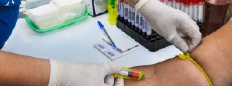 Jejum prolongado poderá ser dispensado em alguns exames de sangue